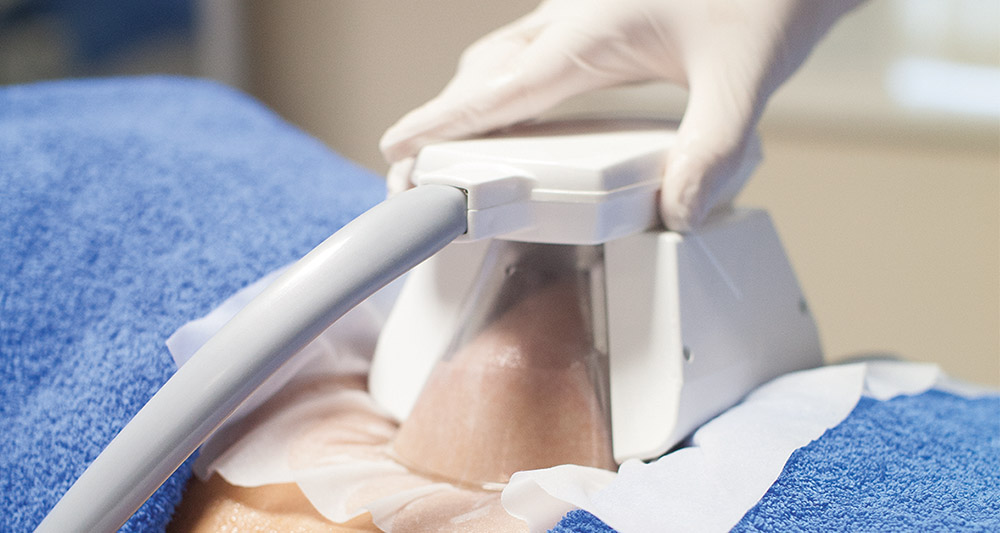 How Fat Freezing and HIFU Work Together? 2 Multiple Areas in One Session HIFU and Fat Freezing Uckfield